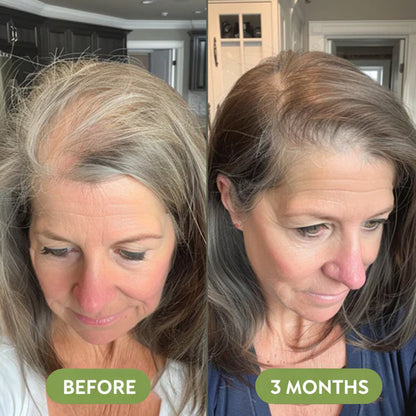 TAILEDEN™ Natural Hair Growth Oil (60ml)🌿 Plant-Based Scalp Care for Long-Term Hair Health