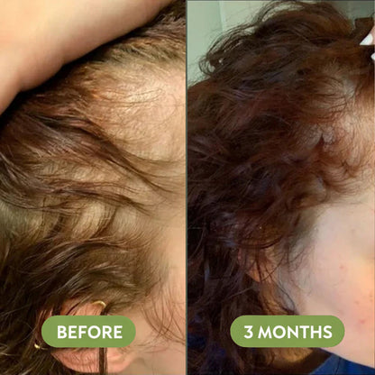 TAILEDEN™ Natural Hair Growth Oil (60ml)🌿 Plant-Based Scalp Care for Long-Term Hair Health