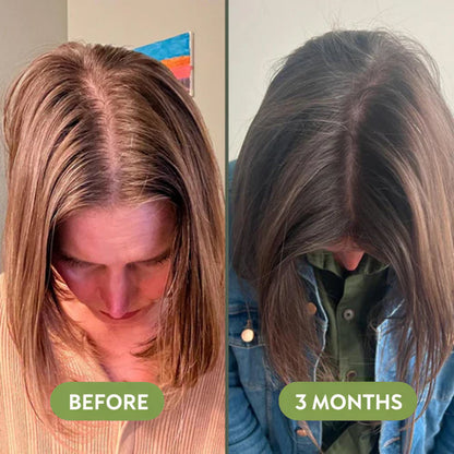 TAILEDEN™ Natural Hair Growth Oil (60ml)🌿 Plant-Based Scalp Care for Long-Term Hair Health