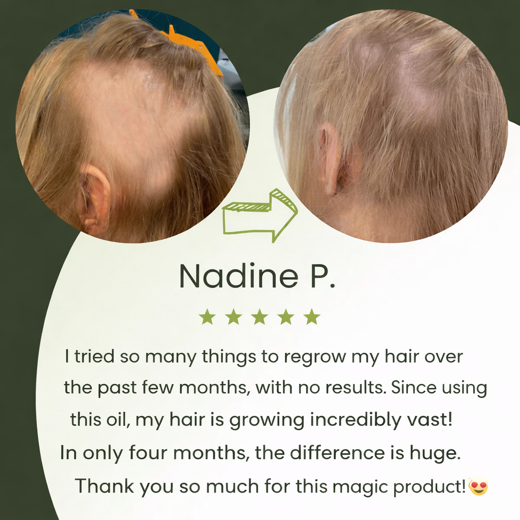 TAILEDEN™ Natural Hair Growth Oil (60ml)🌿 Plant-Based Scalp Care for Long-Term Hair Health