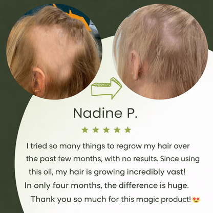 TAILEDEN™ Natural Hair Growth Oil (60ml)🌿 Plant-Based Scalp Care for Long-Term Hair Health