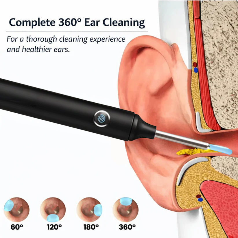 ⏳Limited Time 50% Discount💥NESLEMY Intelligent Waterproof Visual Earwax Remover